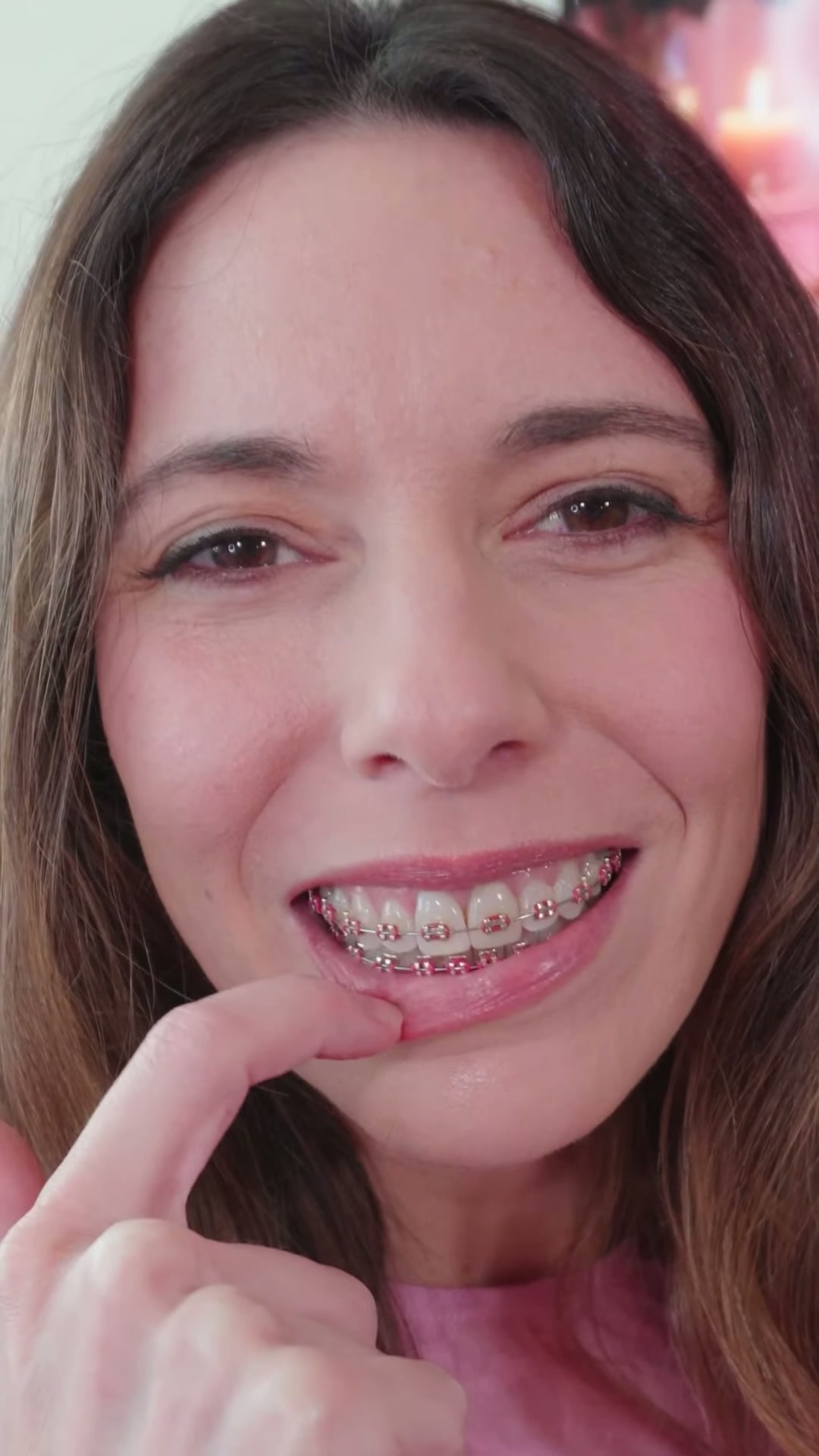 Check out my cute braces smile today