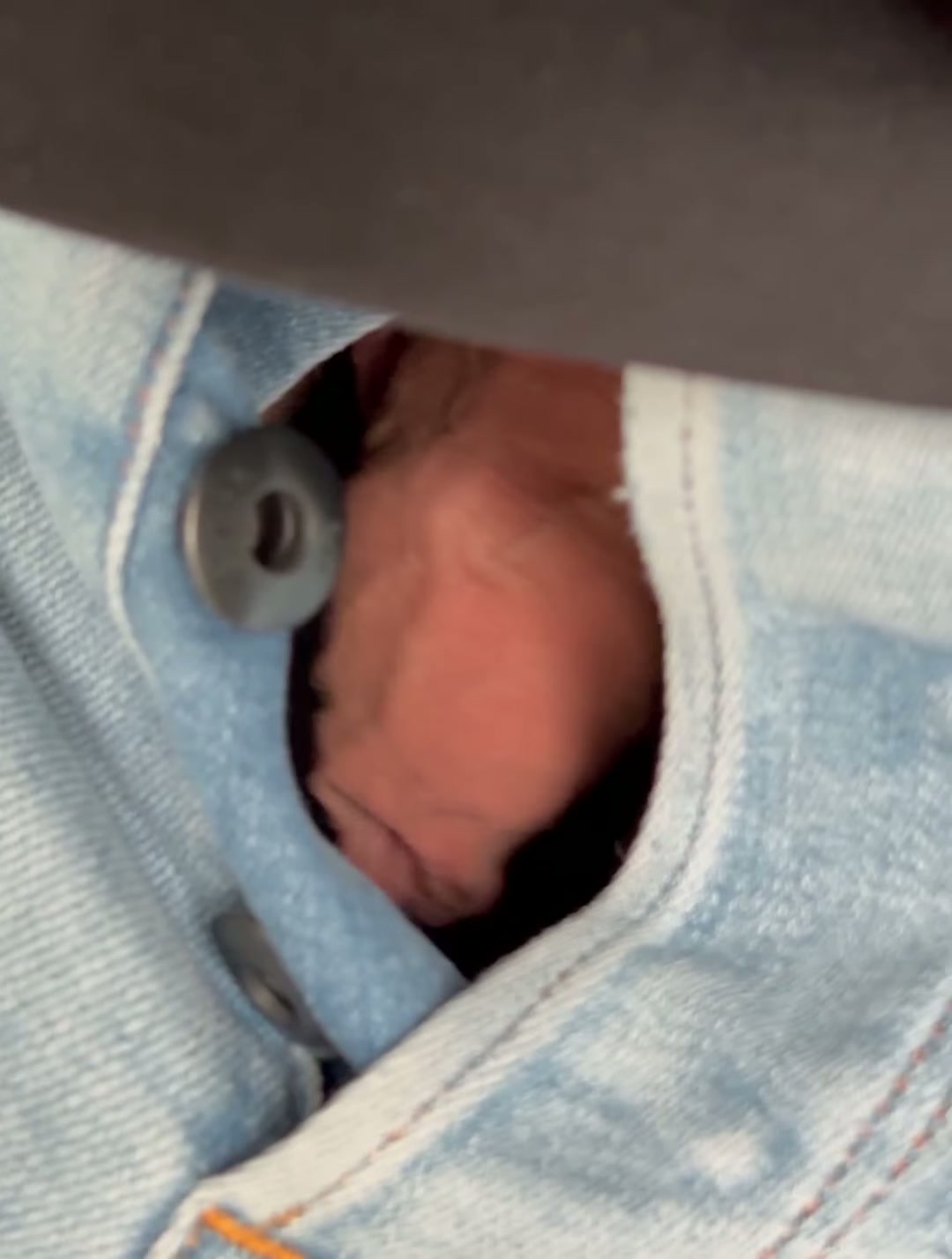 my foreskin slipped into view