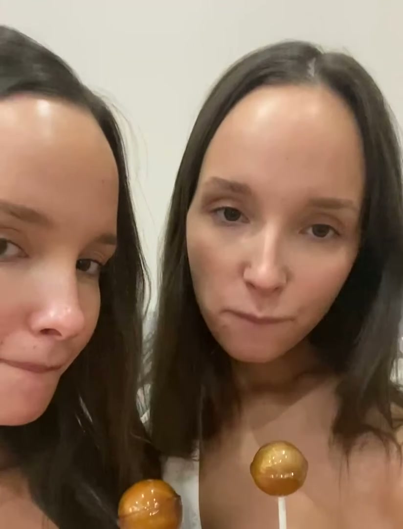 Forehead Twins